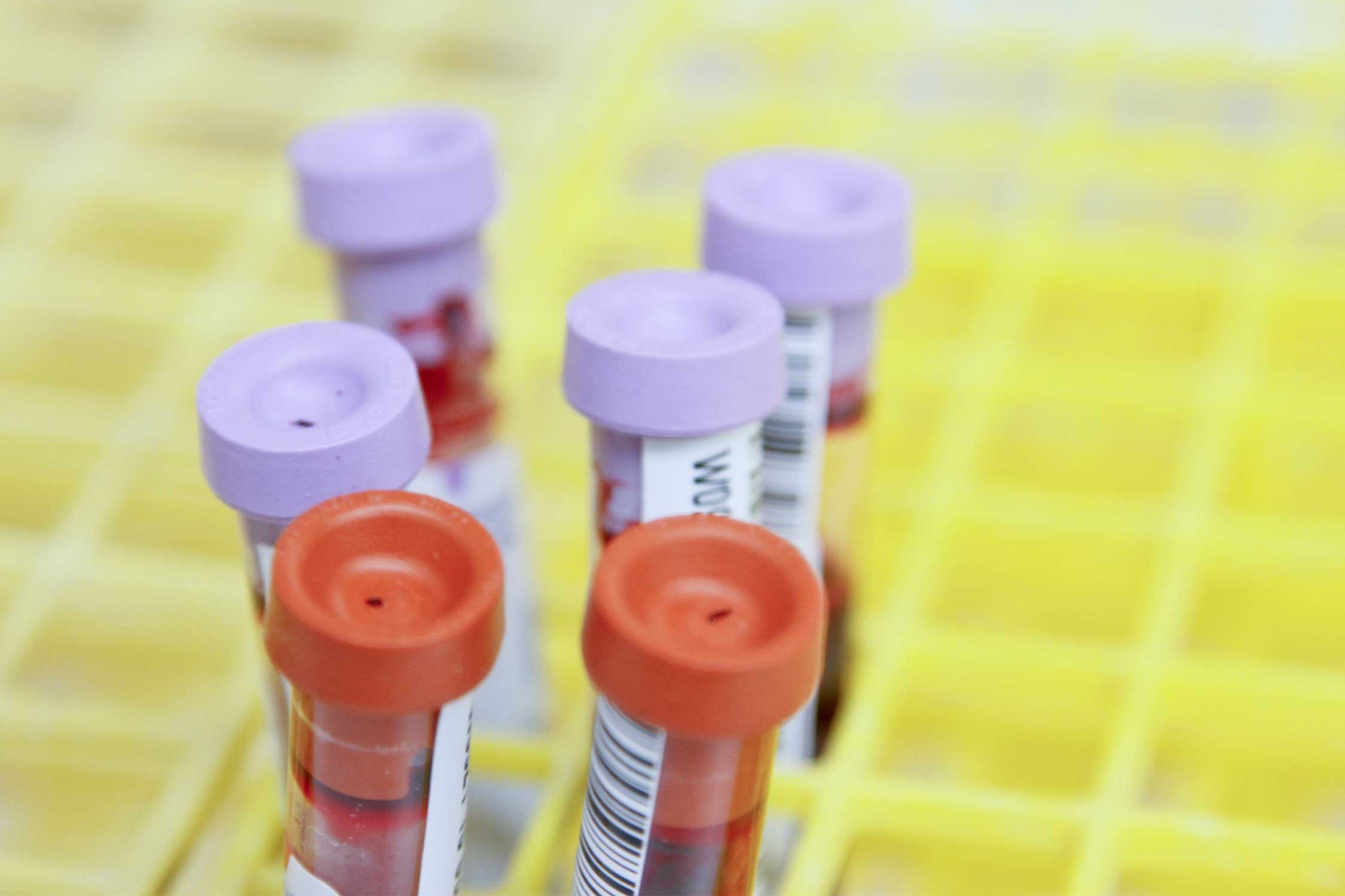 vials for blood work